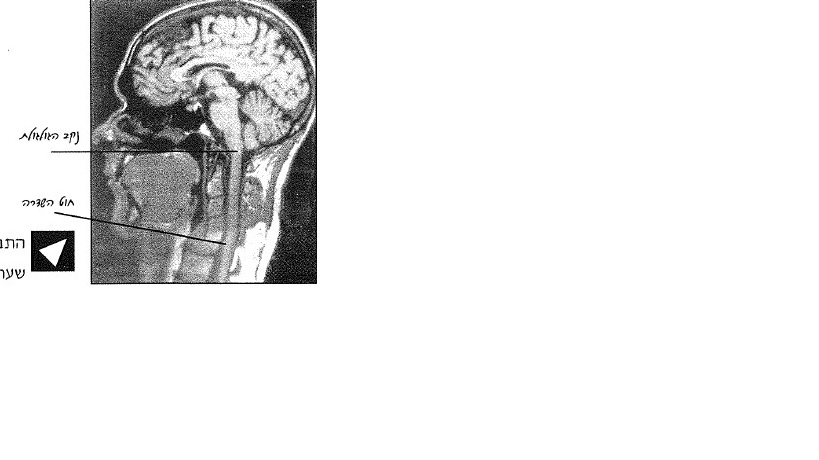סריקת מוח ועמוד שדרה ב-: MRI נקב הגולגולת, חוט השדרה